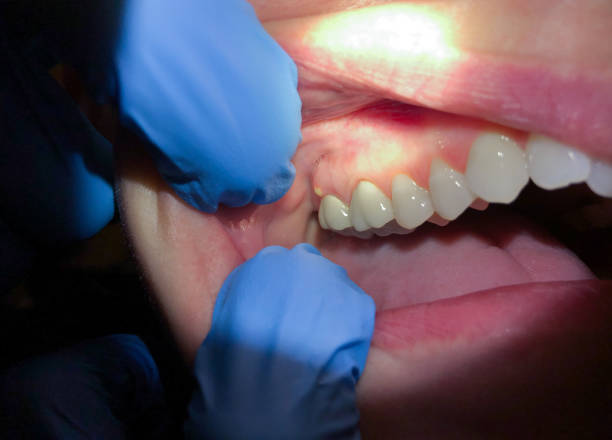 Best Pediatric Emergency Dentist in Brookville, PA
