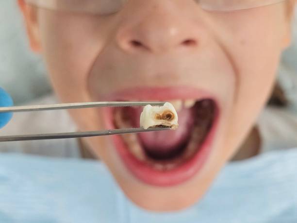 Best Weekend Emergency Dentist in Brookville, PA