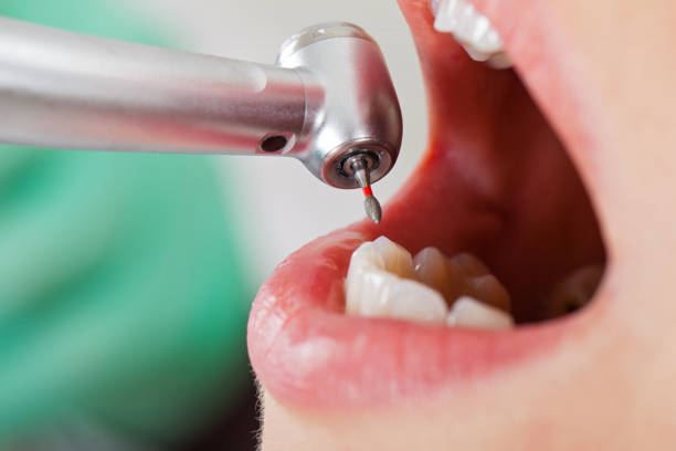 Best Emergency Tooth Extraction in Brookville, PA